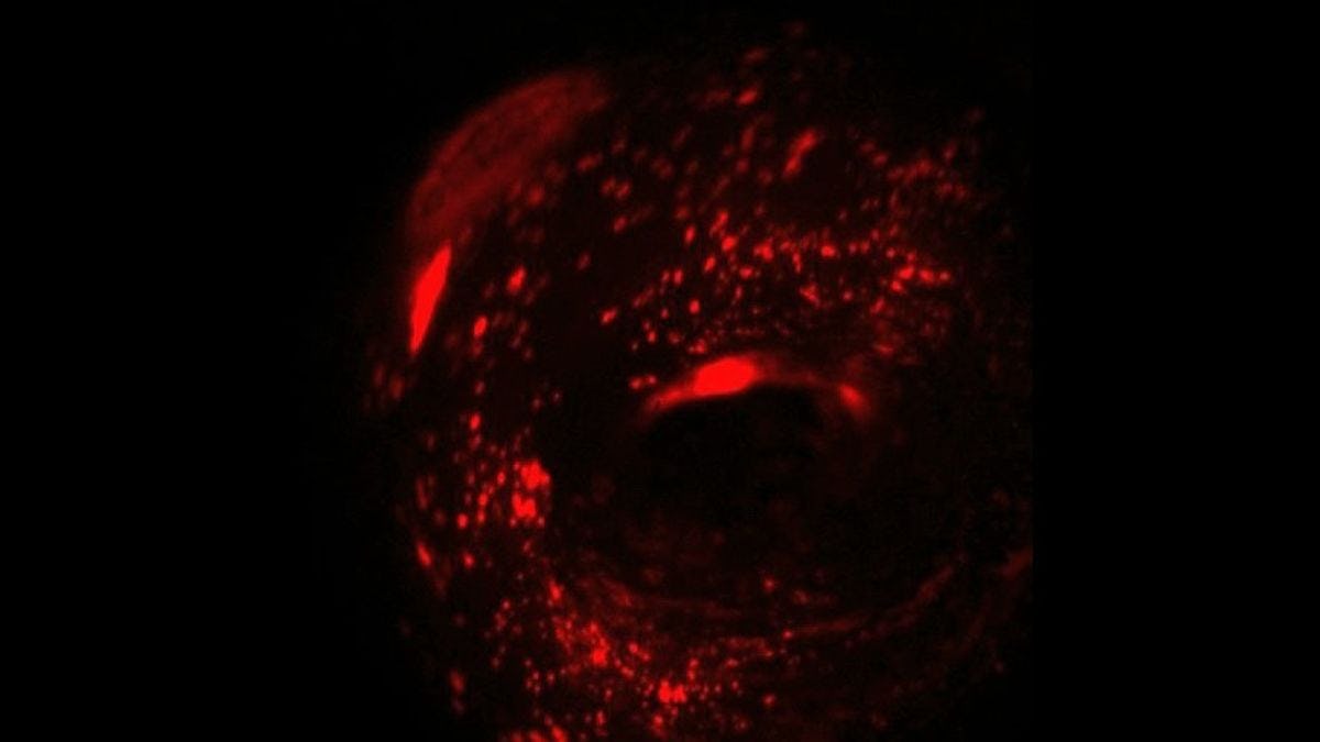Fluorescent imaging devices and systems developed by Stevens professor Jinho Kim allow real-time in situ lung monitoring